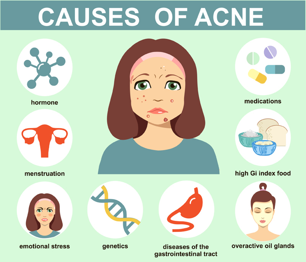 ACNE PRONE SKIN